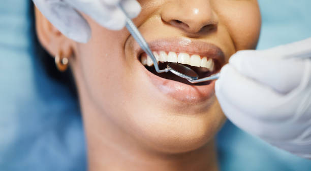 Best Emergency Treatment for Dental Infections or Abscesses in Tamarac, FL