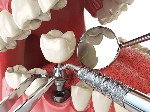 Best Emergency Gum Treatment in Tamarac, FL