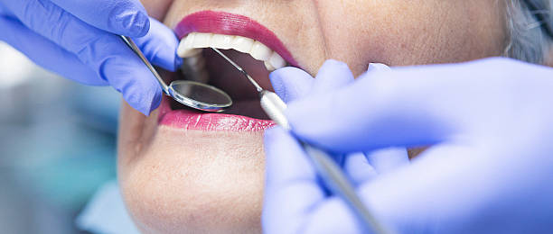 Best Emergency Wisdom Teeth Removal in Tamarac, FL